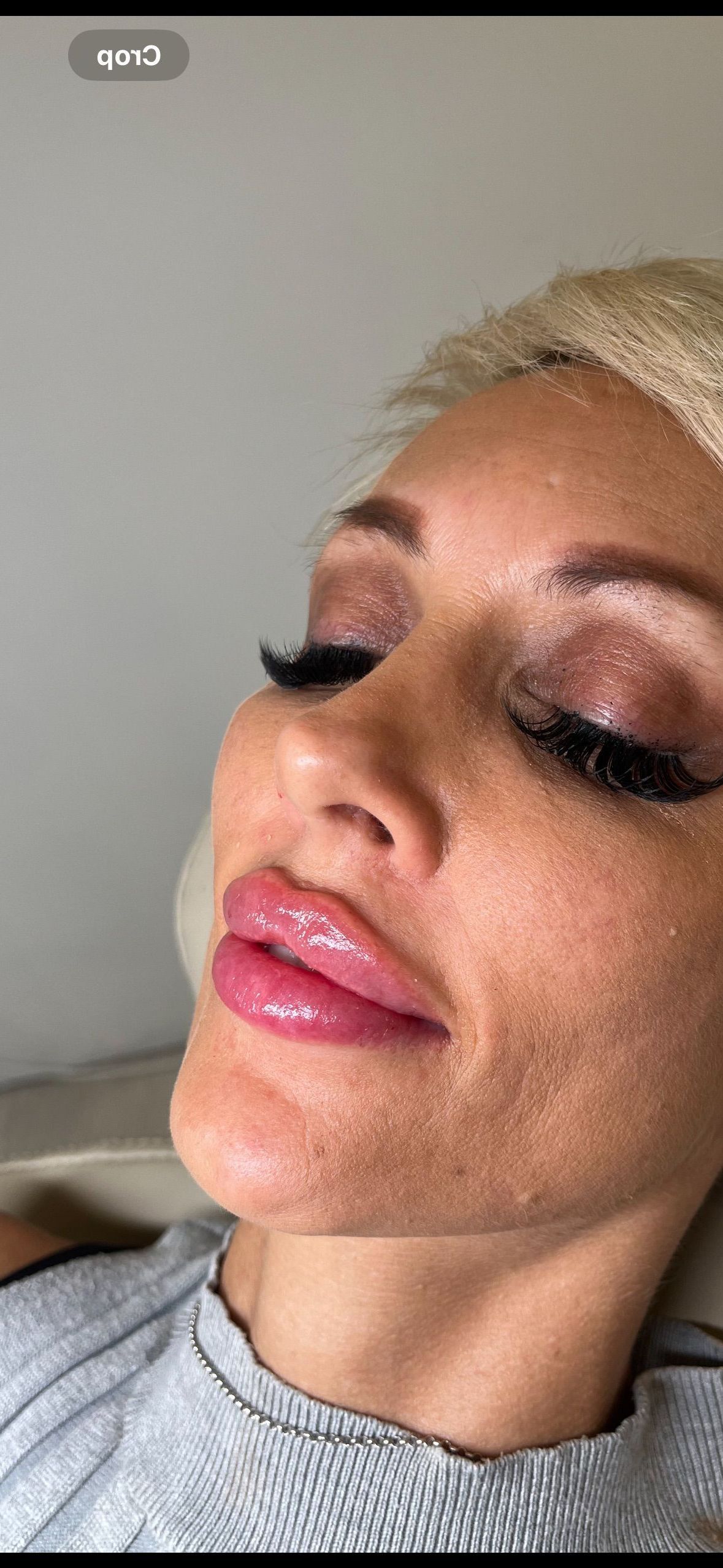 A Close Up of a Woman 's Face With Pink Lips — Doll Empire Clinic in Mermaid Beach, QLD