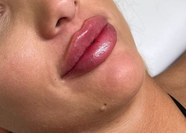 A Close Up of a Woman 's Lips With a Lot of Lipstick on Them — Doll Empire Clinic in Mermaid Beach, QLD