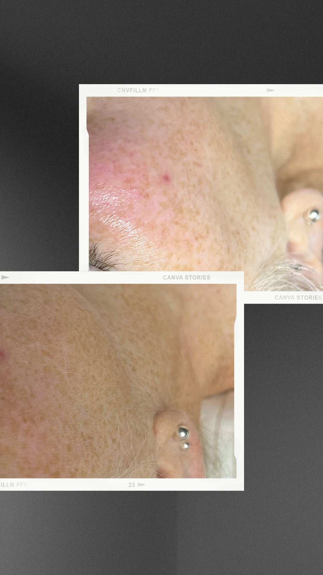 A collage of three pictures of a woman 's face and ear.