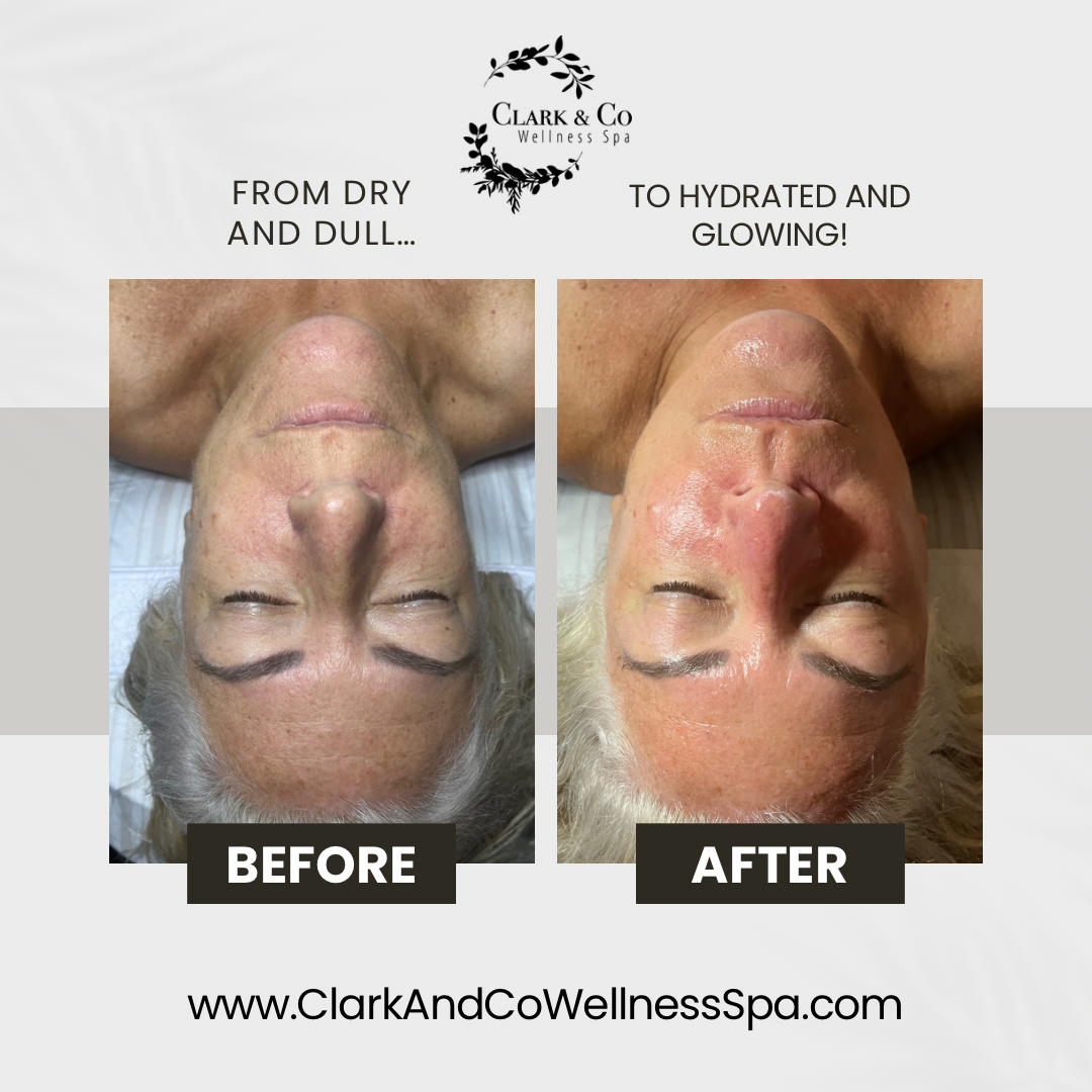 A before and after photo of a woman 's face