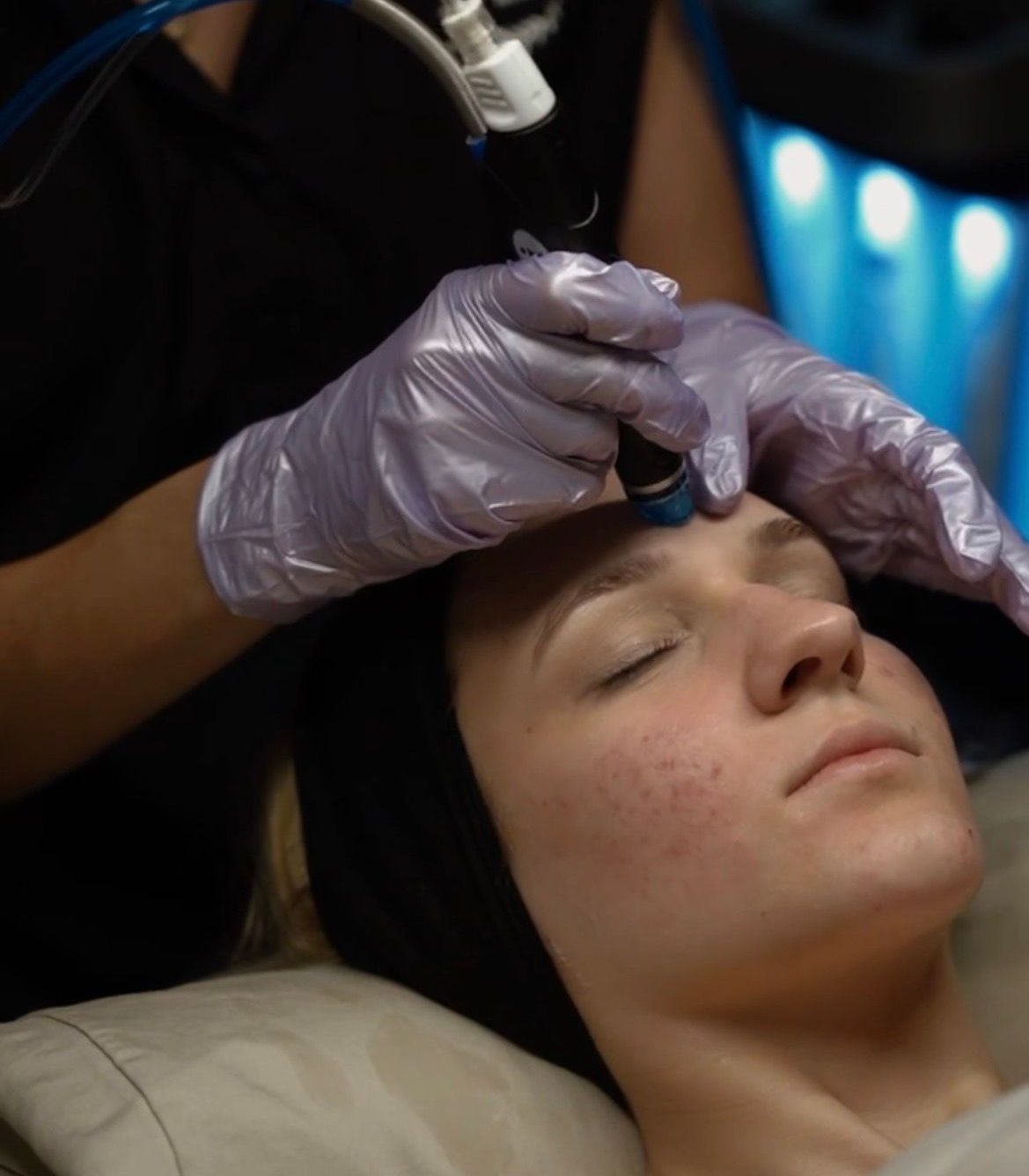 a woman getting hydrafacial