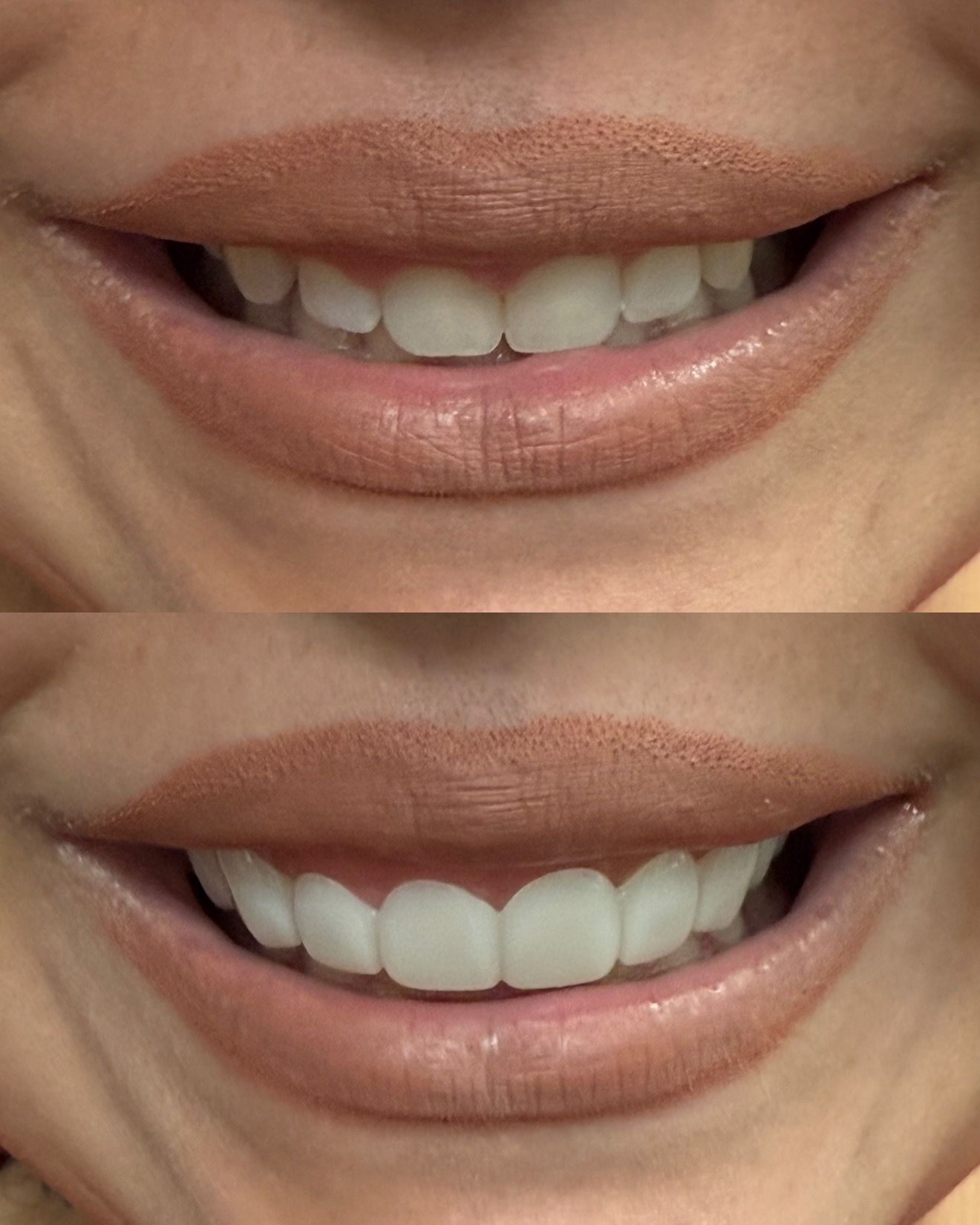 Smiling woman's mouth with teeth. Top: original teeth. Bottom: whiter, seemingly enhanced teeth. Brown lipstick.
