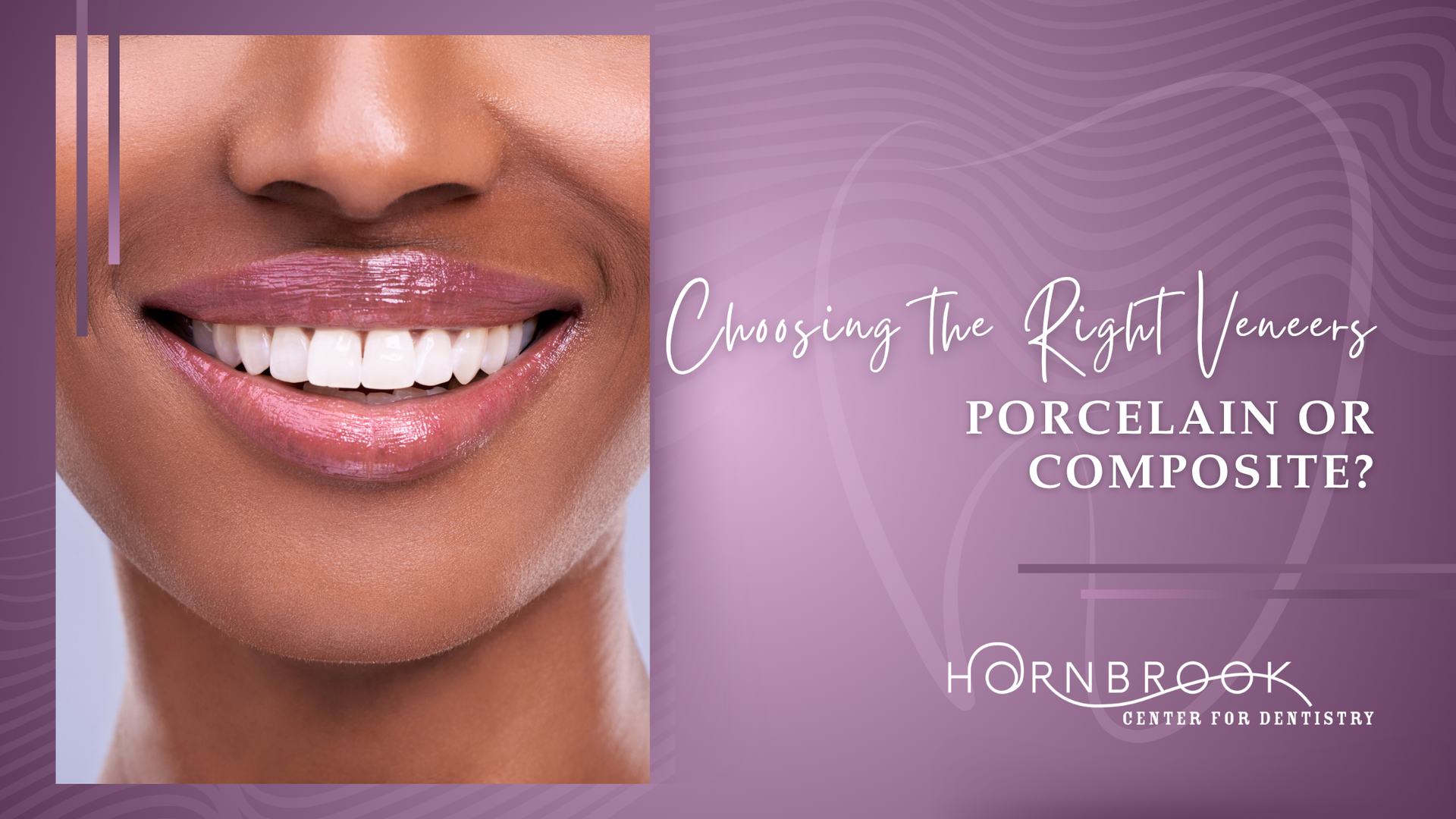 A woman is smiling with porcelain or composite teeth.
