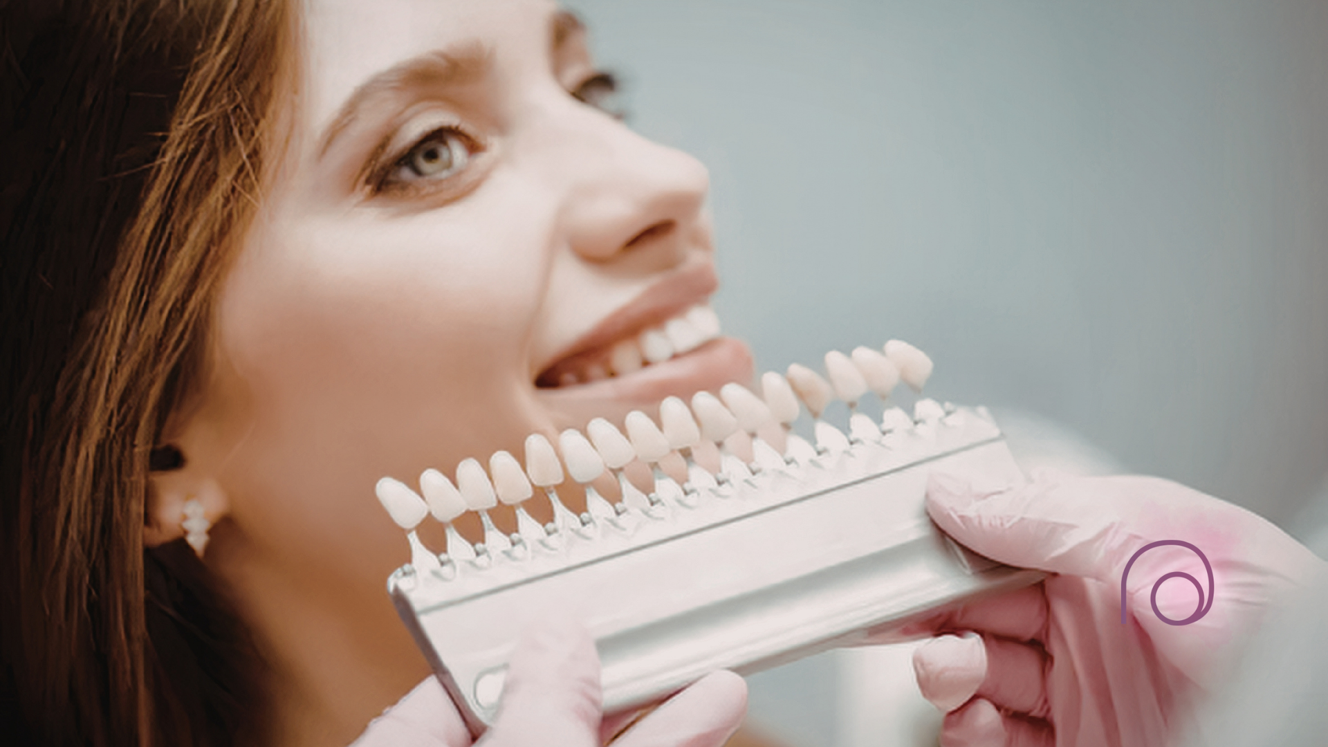 Before-and-after comparison of a smile showing teeth whitening and alignment improvements.