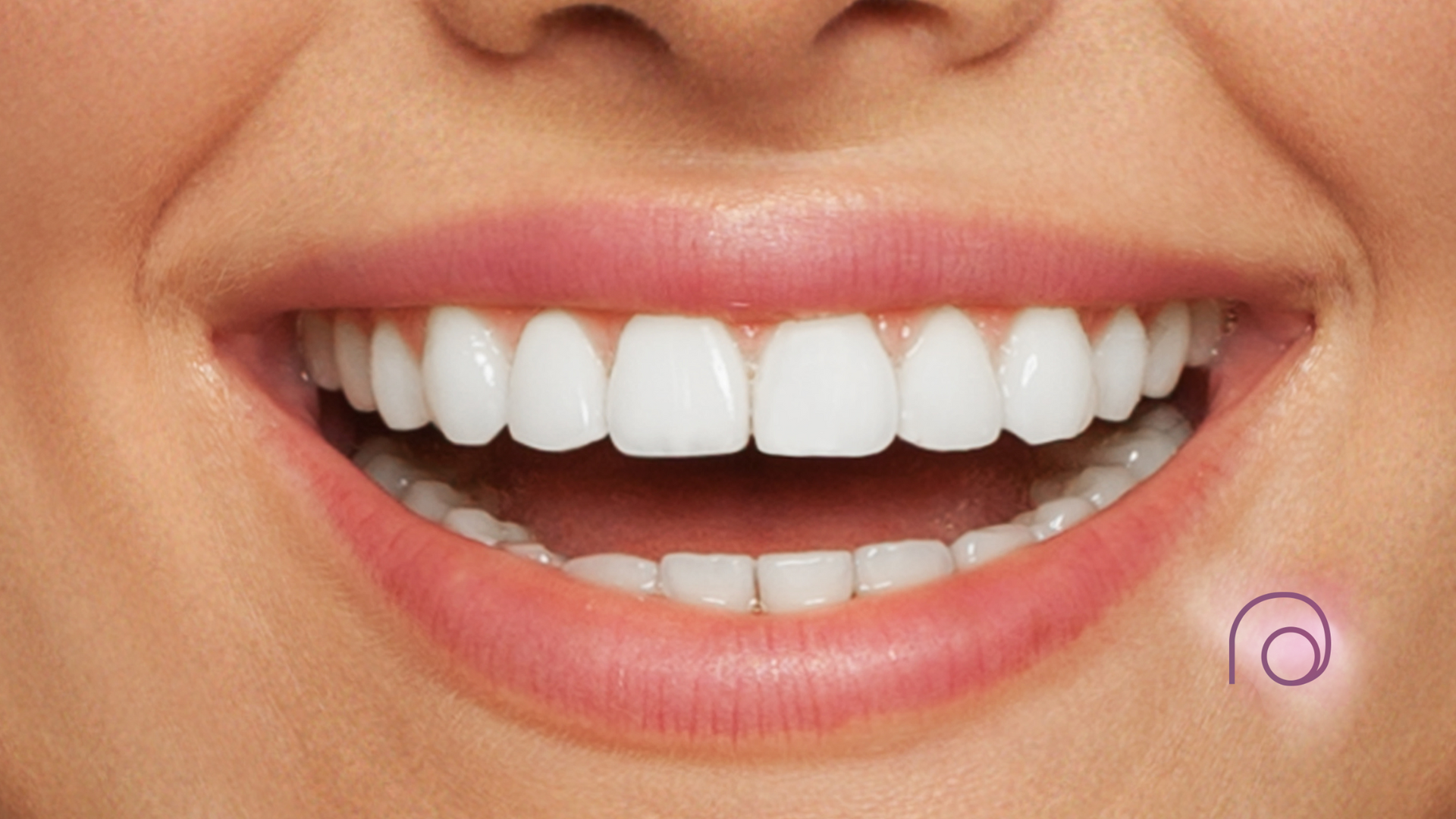 A close up of a woman 's mouth with white teeth and pink lips.