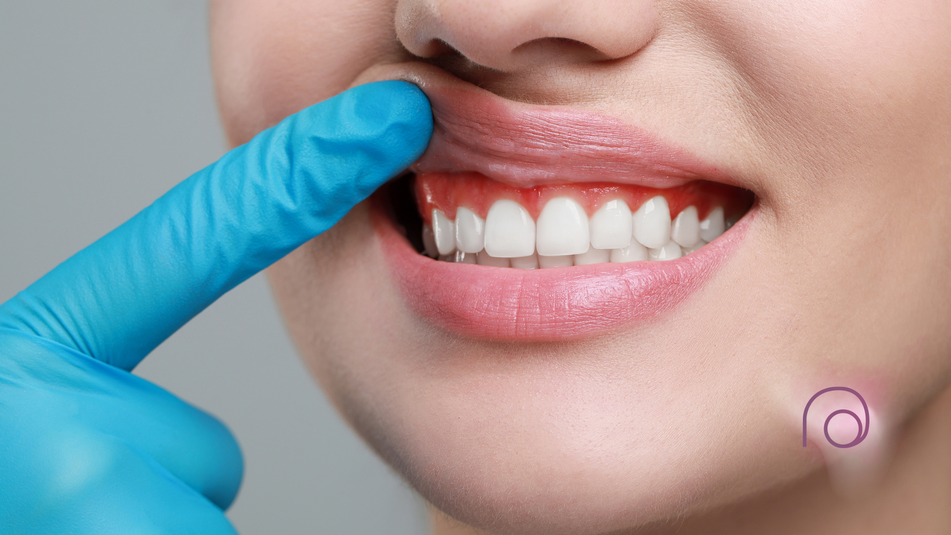 A woman wearing blue gloves is pointing at her teeth.