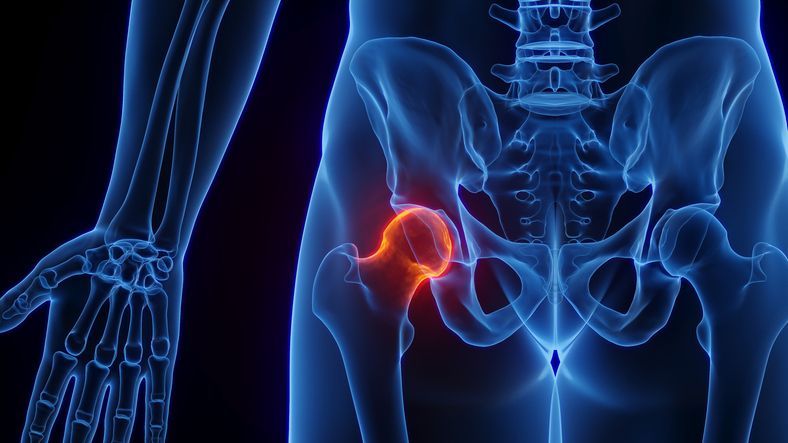 Una radiografia del bacino di una persona con una macchia rossa.