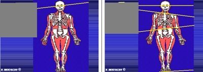 Due immagini di uno scheletro e muscoli su uno sfondo blu