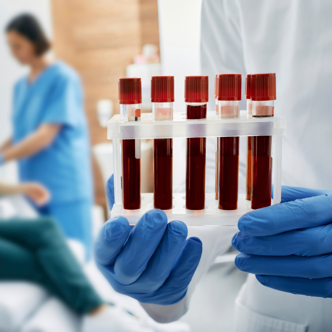 A lab technician in purple gloves holds a row of filled blood-draw vials