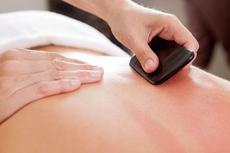Person receiving gua sha treatment on their back, resulting in red marks.
