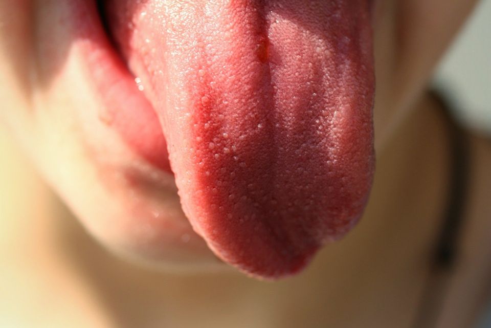 healthy tongue color