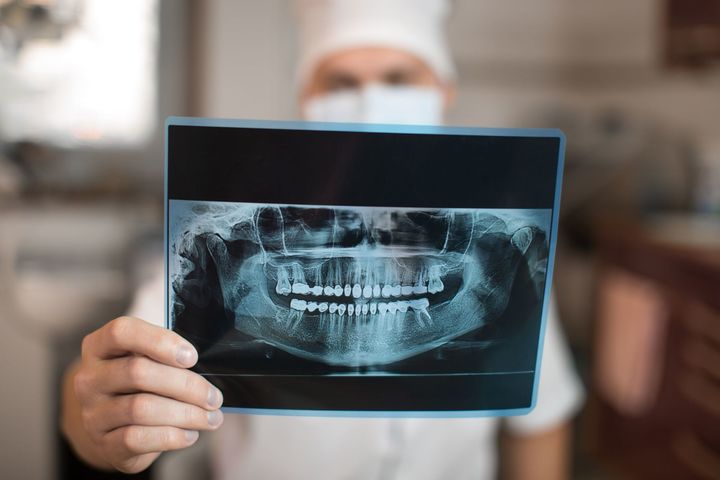 radiografia del cavo orale