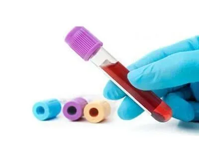 ANÁLISIS CLÍNICOS BACTERIOLÓGICOS SC - SERVICIOS DE LABORATORIO ANÁLISIS CLÍNICOS BACTERIOLÓGICOS SC - SERVICIOS DE LABORATORIO