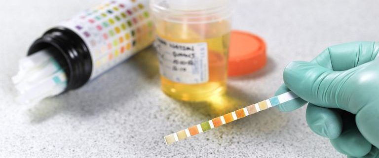 A person is holding a test strip in front of a cup of urine.