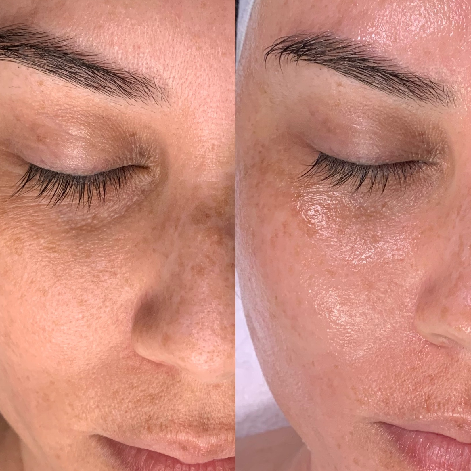 Ein Vorher-Nachher-Foto des Gesichts einer Frau mit geschlossenen Augen.