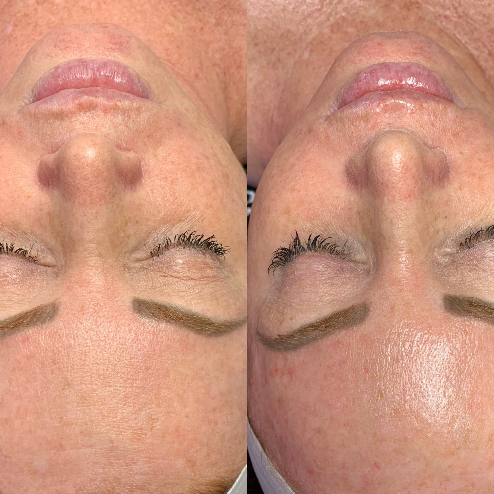 Ein Vorher-Nachher-Foto des Gesichts einer Frau mit geschlossenen Augen.