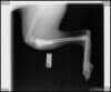 Pet Care Center — Side View of X-Ray with Bone Plate in Edmonds, WA
