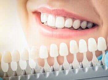 Improve Tooth Whitening — Complete Dentures in Bend, OR