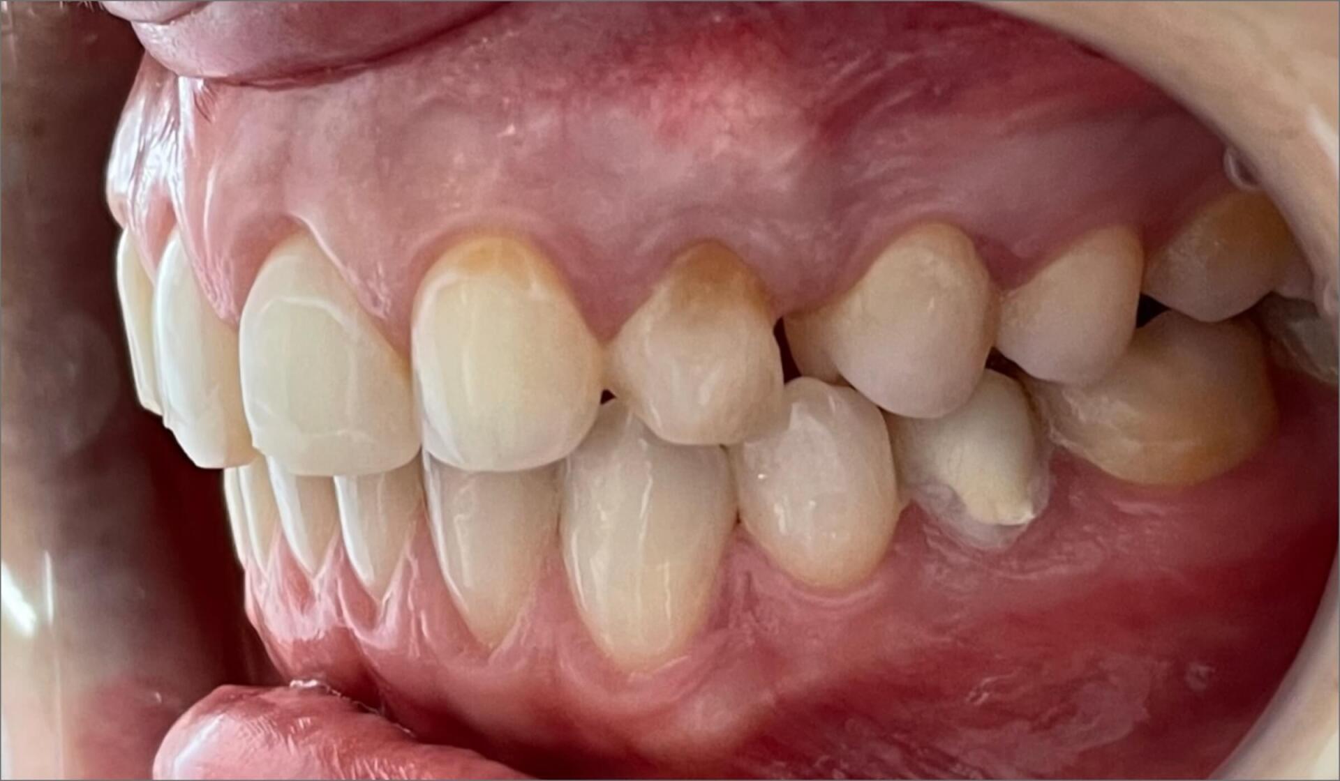 Somersmile Dental before