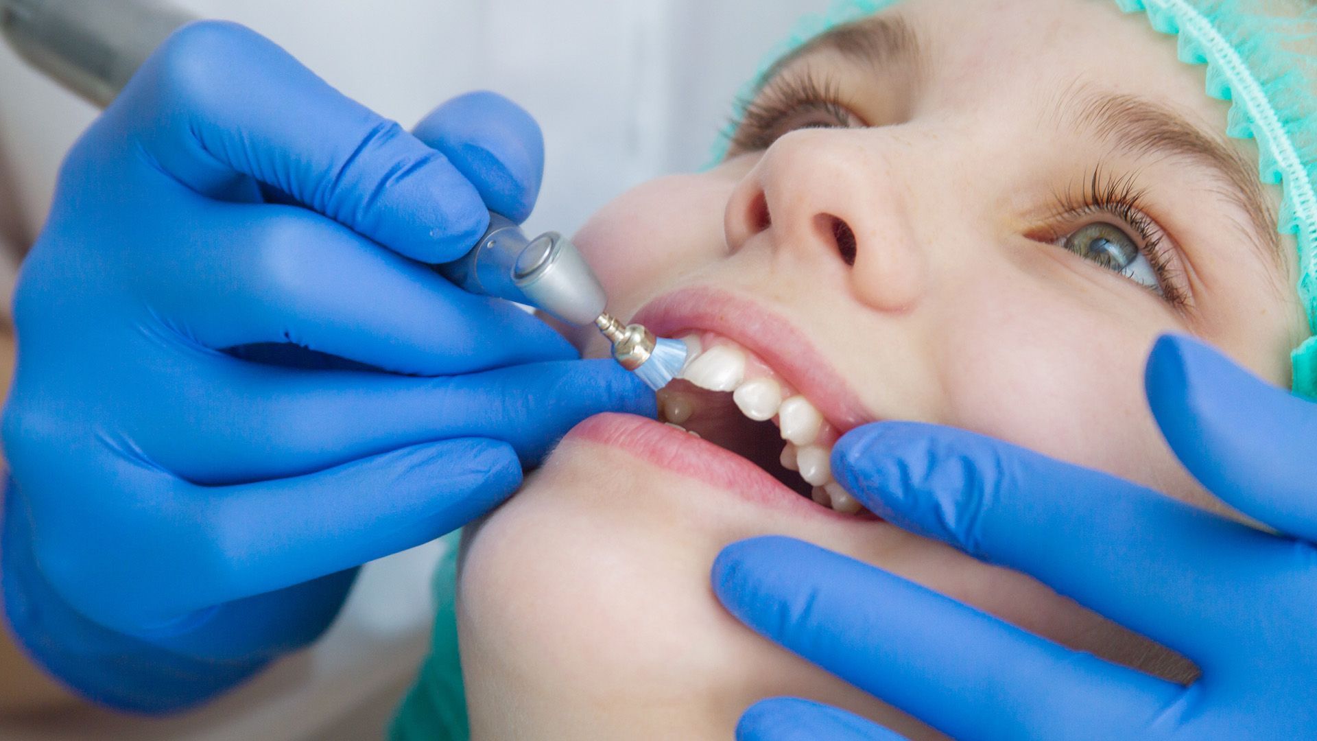 How Fluoride Treatments for Kids Work