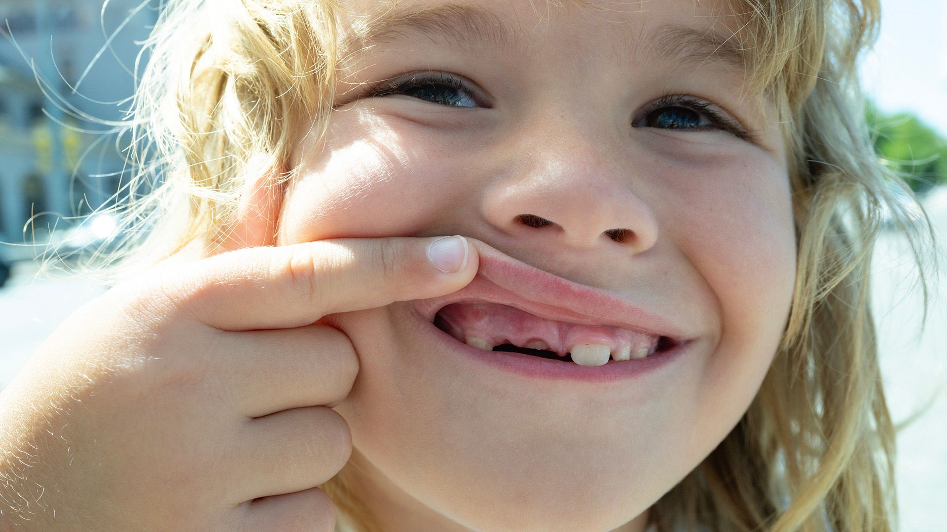 What to Do If Your Child Knocks a Tooth Loose