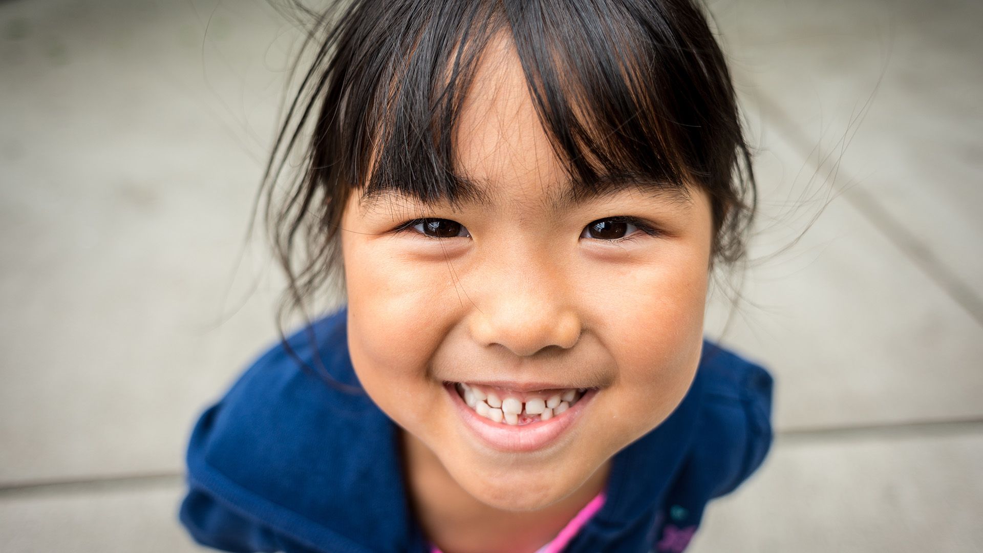 What causes gingivitis in kids