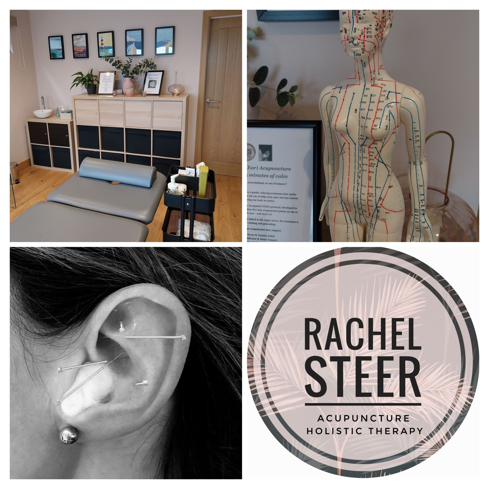 A lady is having acupuncture