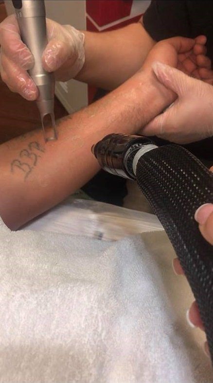 Houston Tattoo Removal | Laser Tattoo Removal Houston | Clearstone Laser  Hair Removal & Medical Spa | Clearstone Laser Hair Removal & Medical Spa