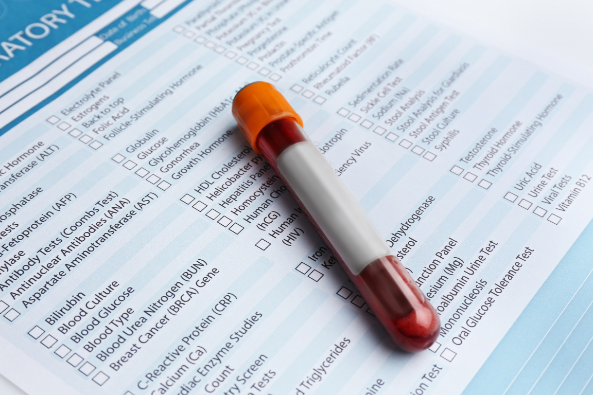 Blood test vial with orange top on a laboratory test request form.