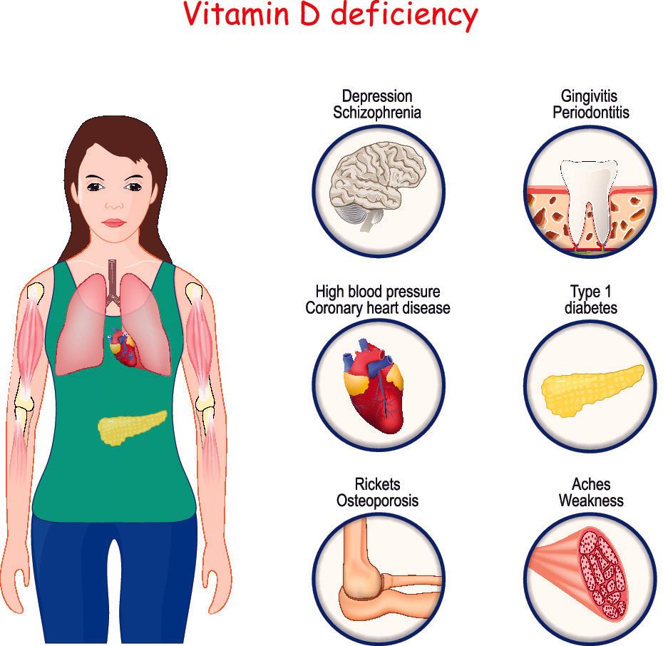 Osteoporosis - Diagnosis and Treatment