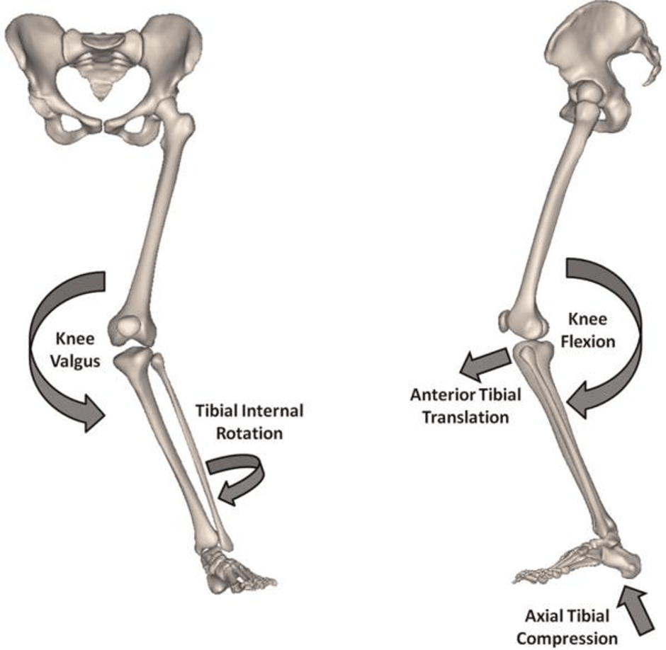 Anterior Cruciate Ligament - Rehabilitation, Treatment | Dr A Theodorides