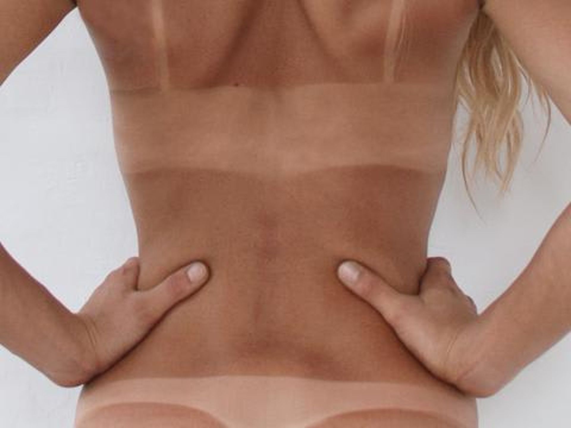 Person's back with severe tan lines from clothing.