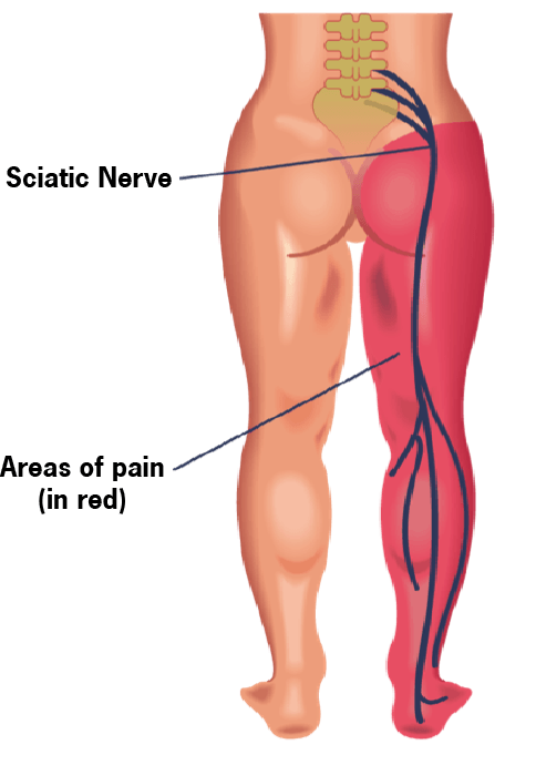 Leg Pain, Comprehensive Medical Care