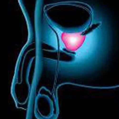 DR JORGE E. JUAREZ PEÑA-Diagnóstico en problemas de todo el tracto urinario