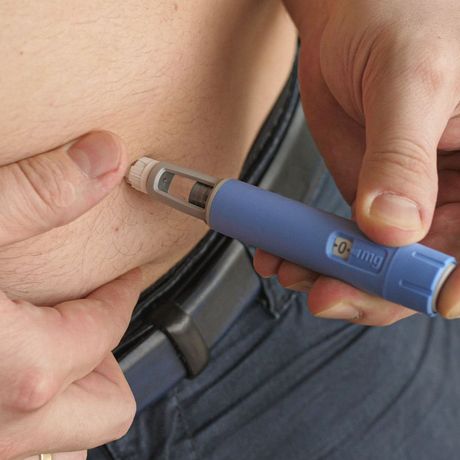 Advanced Bone & Body Composition Testing