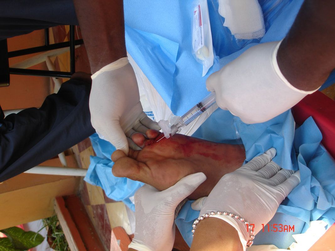 A person is getting a needle in their hand