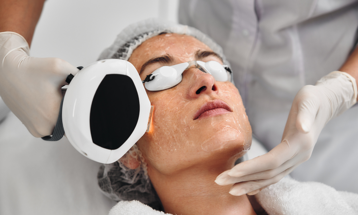 IPL : traitement des taches, rougeurs, acné et relâchement cutané. La lumière pulsée intense amélior