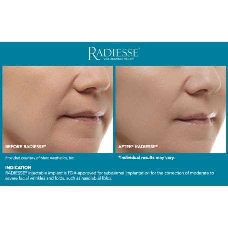 radiesse rouen dr yaeche