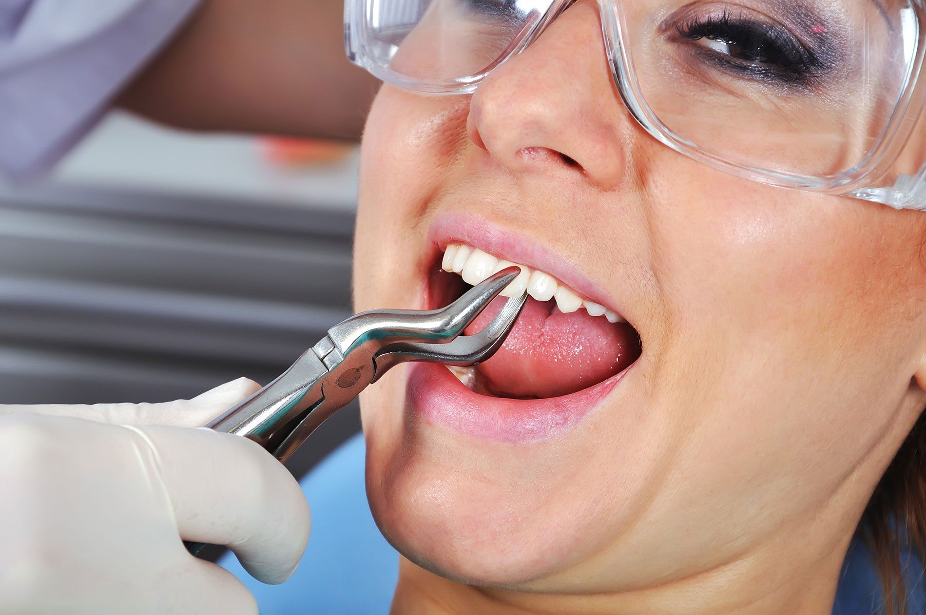 Tooth Extractions | Orchard Park, NY