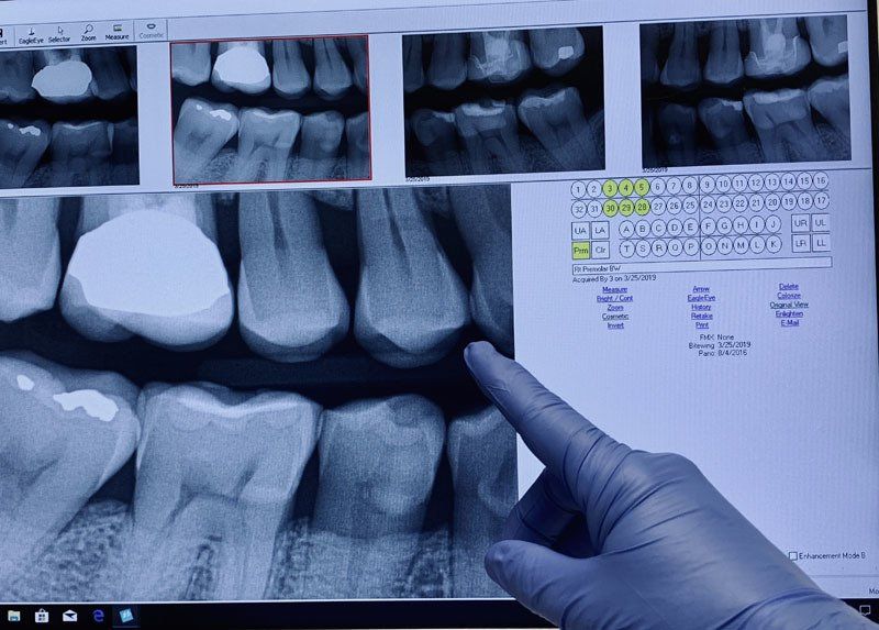 General Dentistry DENTAL X-RAY Hamburg, NY