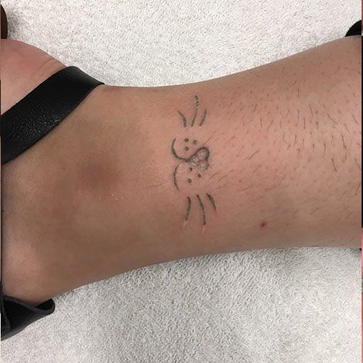 A person has a tattoo on their ankle that looks like a cat