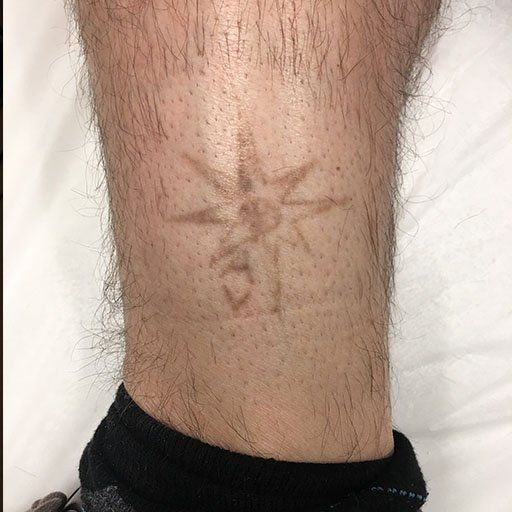 A man 's leg with a tattoo of a spider on it
