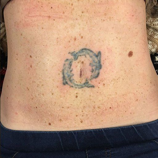 A woman has a tattoo of two dolphins on her stomach