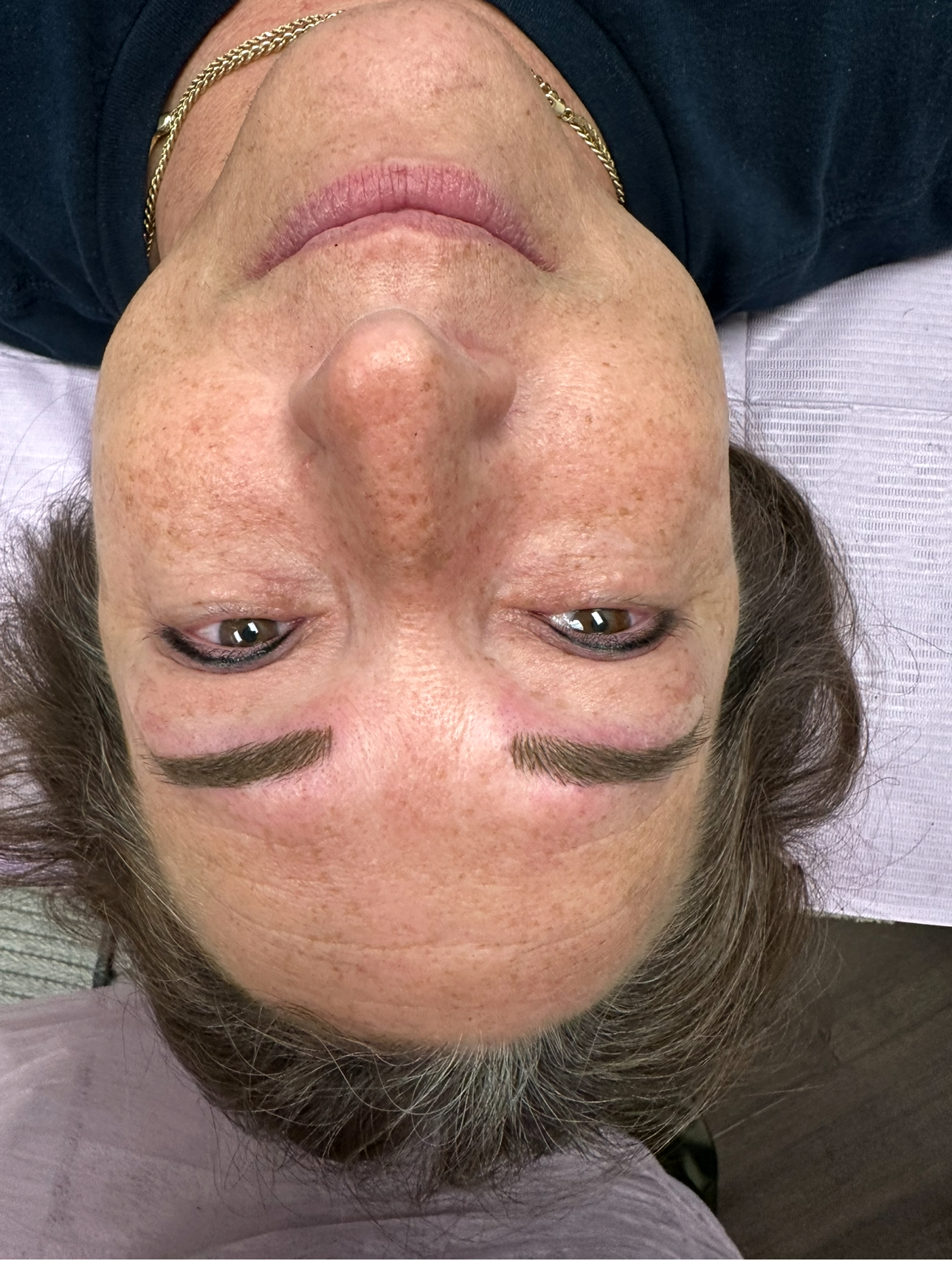 Close-up of a person's face with freshly tattooed eyebrows and eyeliner. The person is looking up.