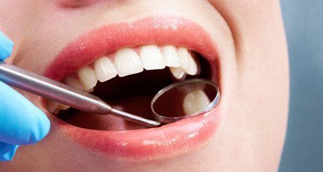 Chipped Tooth Repair and How A Cosmetic Dentist Can Help - Cheadle