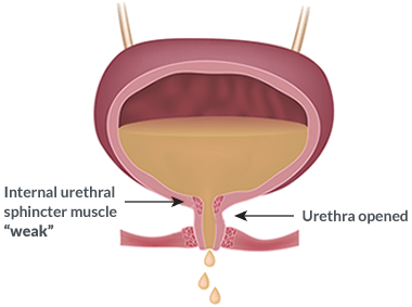 diagram of a urethra