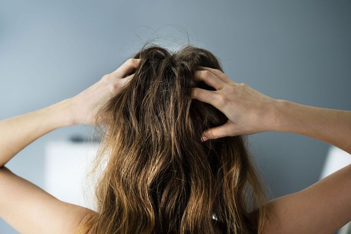 Person scratching their head with both hands; dry, frizzy brown hair.
