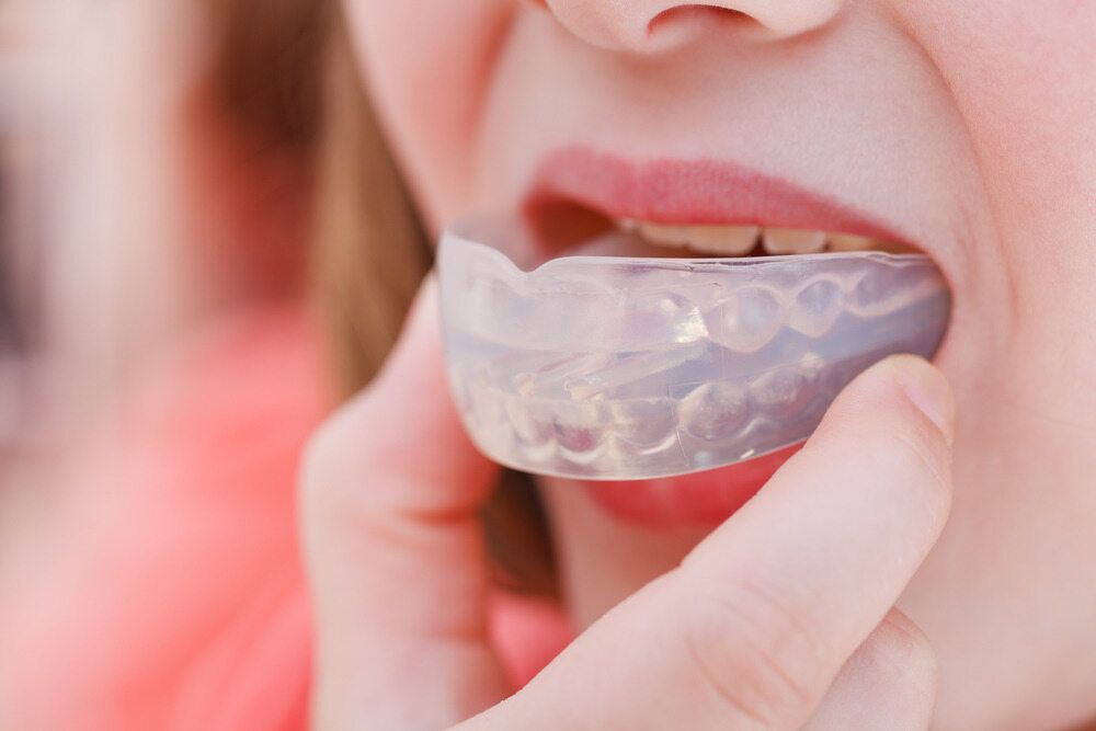 A Woman is Holding a Mouth Guard in Her Mouth — Parap Family Dental in Parap, NT