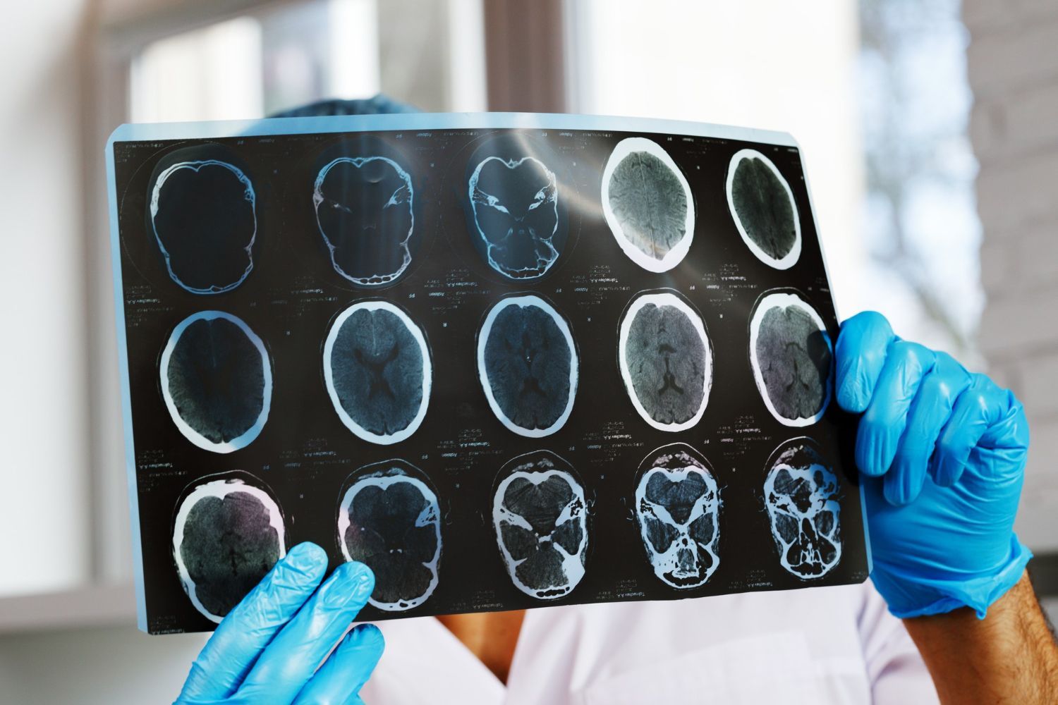 A doctor is holding a ct scan of a person 's head.