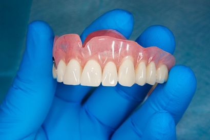A Person is Holding a Denture in Their Hand — Burleigh Heads Denture Clinic Gold Coast in Burleigh Heads, QLD